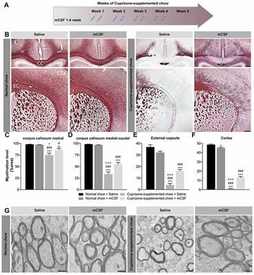 mCSF-Induced Microglial Activation Prevents Myelin Loss and Promotes Its Repair in a Mouse Model of Multiple Sclerosis